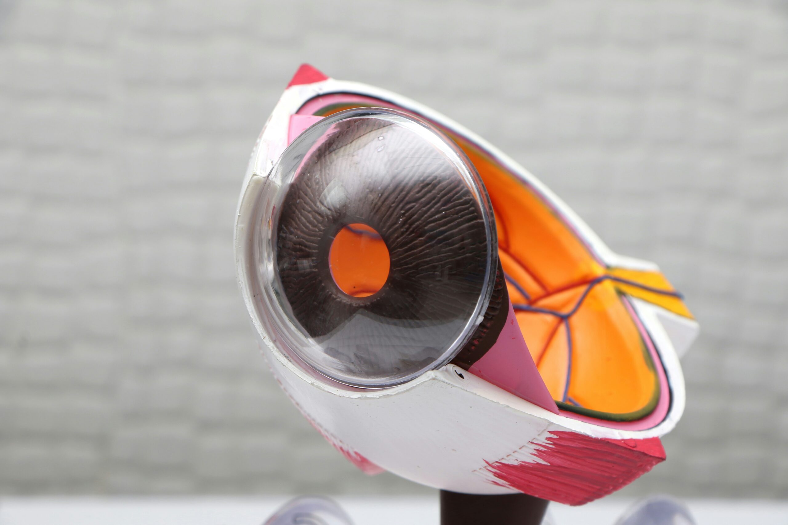 The Ortho-K Treatment Process | Orthokeratology Sydney