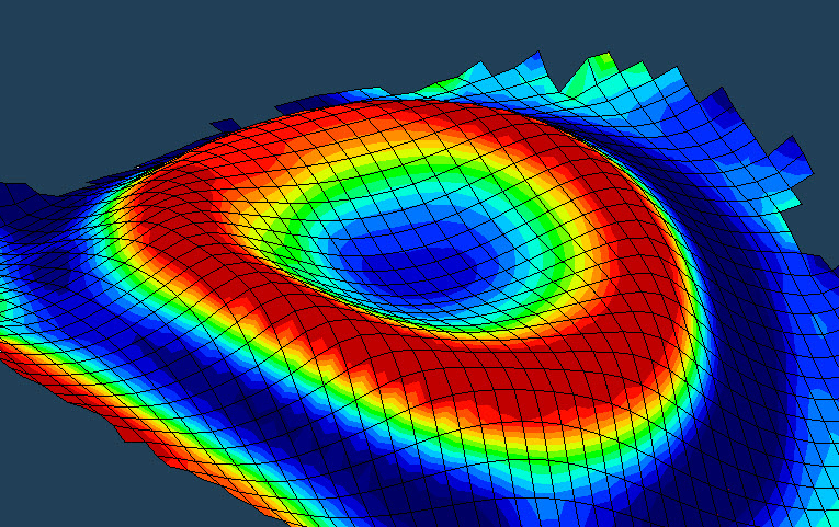 orthokeratology topography | Orthokeratology Sydney